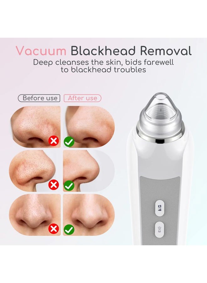 TTozka Blackhead Remover Vacuum, Black Head Remover for Face with Canera, Pore Vacuum for Men and Women, USB Interface Type Blackhead Remover Tools, Equipped with 6 Suction Heads and 3 Gears - Image 5