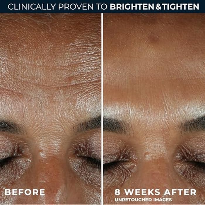 RoC Multi Correxion Revive + Glow 10% Active Vitamin C Serum for Face, Daily Anti-Aging Wrinkle and Skin Tone Skin Care Treatment, Brightening Serum , 1 Fluid Ounce - Image 4