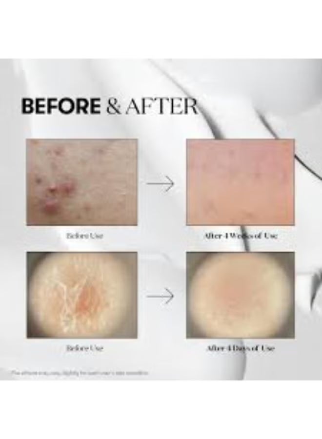 celimax Reedle Shot 100 Essence for All Skin Types 50ml - Image 2