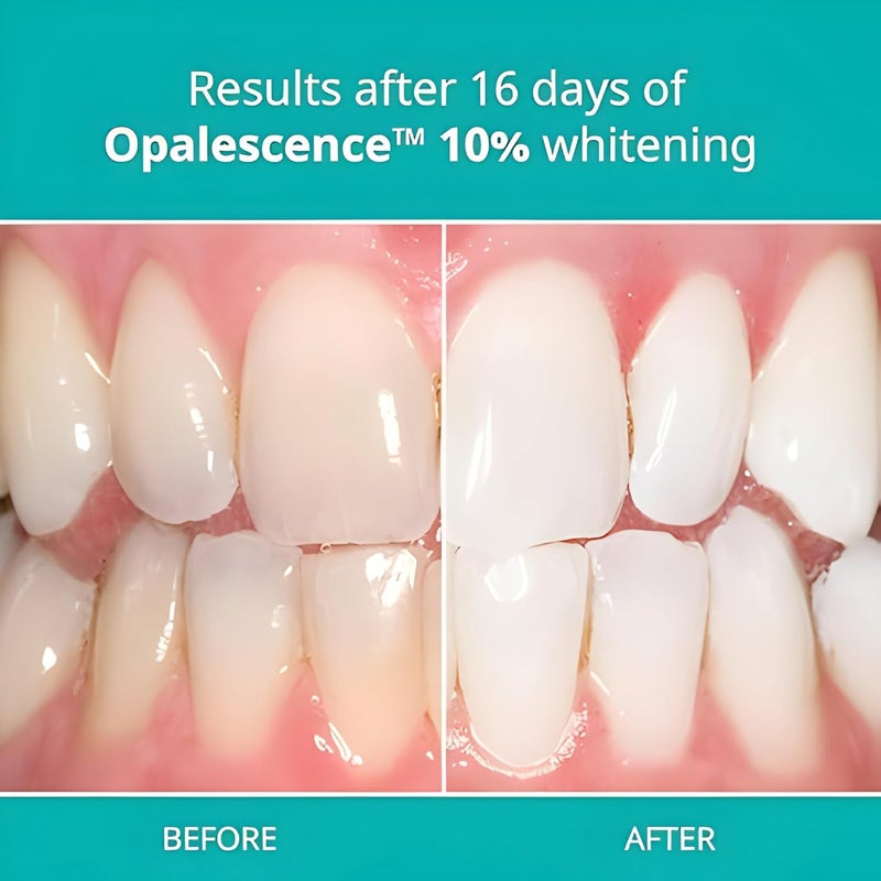 Opalescence PF 10% Tooth Whitening Gel - 4 Syringes with Melon Flavor - Image 3