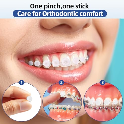 RAZOKO Orthodontic Wax for Braces Wax Dots 120 Individual Hygienic Packaging Dental Wax Mint - Image 4
