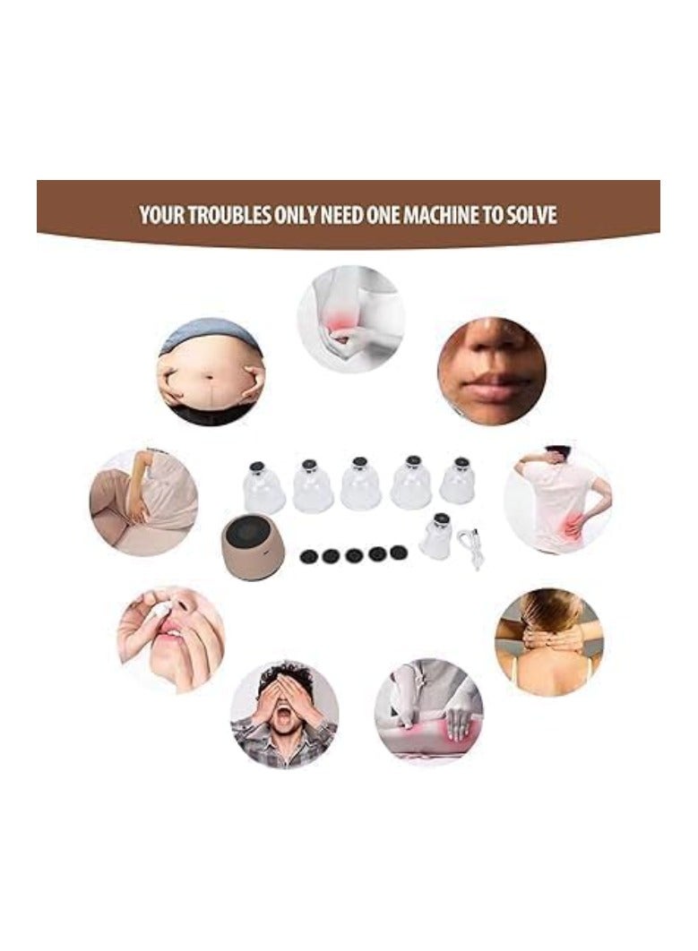 مجموعة الحجامة الكهربائية، جهاز تدليك الحجامة الكهربائي الذكي، جهاز الحجامة ألفا القابل لإعادة الشحن، مجموعة العلاج بالحجامة الكهربائية الذكية - متعدد الألوان - Image 4