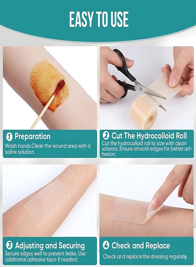 Mokleva Medical Grade Hydrocolloid Dressing Roll 5cm x 500cm(16.5Feet) For Wound & Acne Care, Waterproof Cut-to-Fit Tape Patch For Blisters, Burns, Bed Sores, Ulcers, Pimple Patches, Skin Protection - Image 5