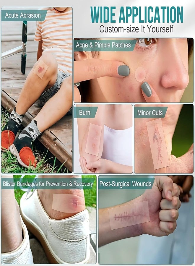 Mokleva Medical Grade Hydrocolloid Dressing Roll 5cm x 500cm(16.5Feet) For Wound & Acne Care, Waterproof Cut-to-Fit Tape Patch For Blisters, Burns, Bed Sores, Ulcers, Pimple Patches, Skin Protection - Image 4