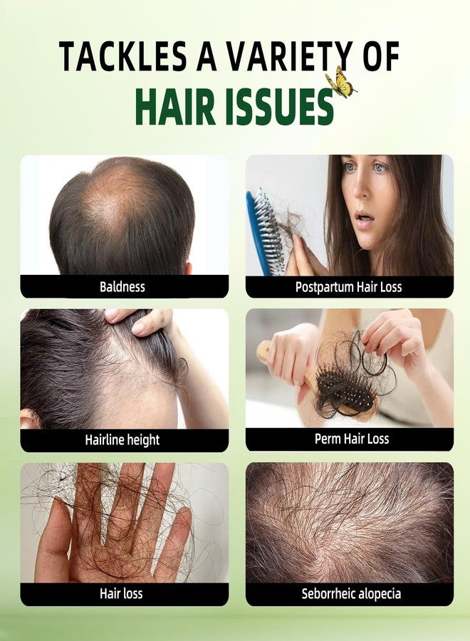 Sunspeak Rosemary Hair Growth Shampoo and Conditioner Set: Thickness & Anti Hair Loss Shampoo and Conditioner with Tea Tree Oil Mint Biotin – Strengthening Formula for Men & Women, Thinning & Damaged Hair Care - Image 4