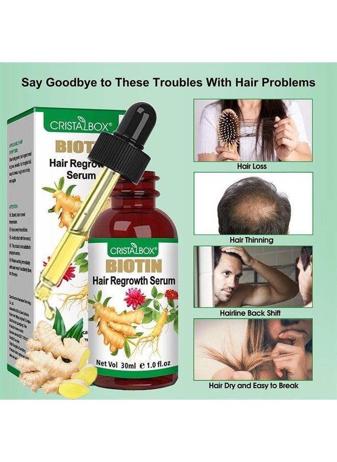 Cristalbox - 5 PACK Ginger Oil for Hair Growth,Hair Growth Serum,Biotin Hair Growth Oil,Hair Growth Ginger Serum for Men and Women,Hair Growth Treatment,Hair Loss Treatment,Promotes Thicker,Growth Hair - Image 1