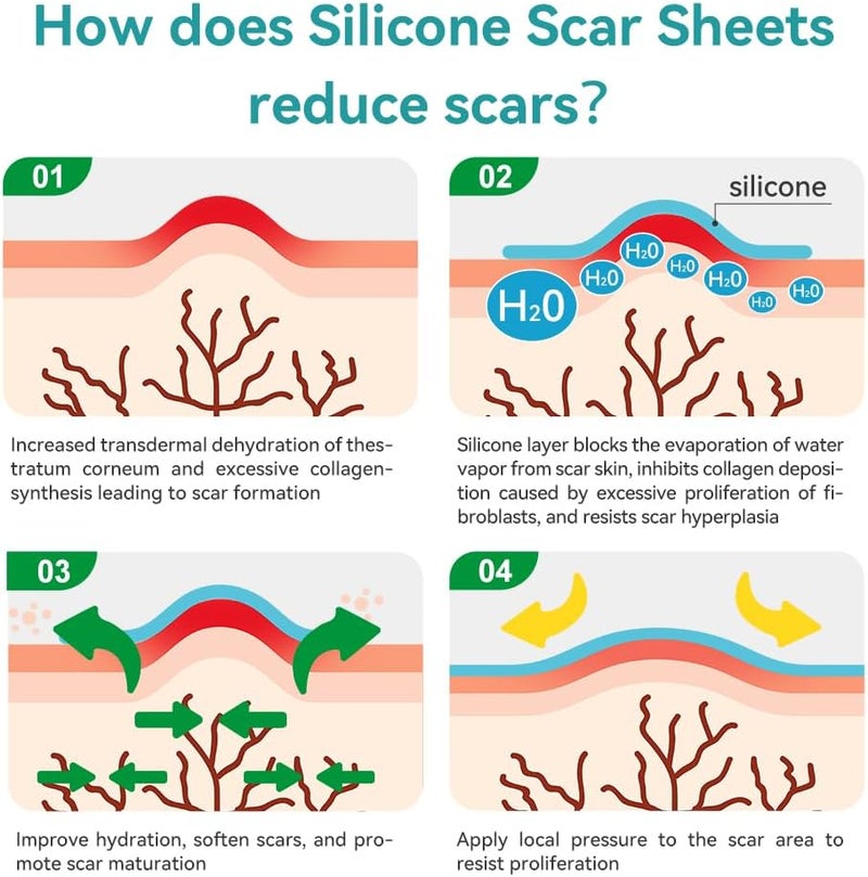Dimora Hydrogel Burn Dressing 4 x 4  Waterproof Silicone Scar Sheets - Image 5