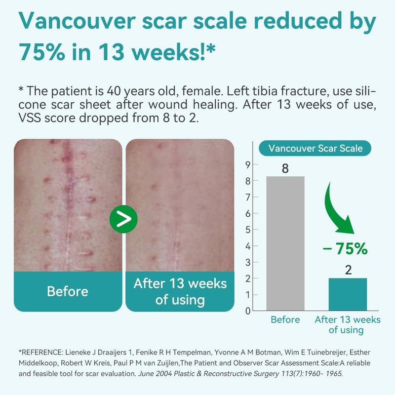 Dimora Hydrogel Burn Dressing 4 x 4  Waterproof Silicone Scar Sheets - Image 3