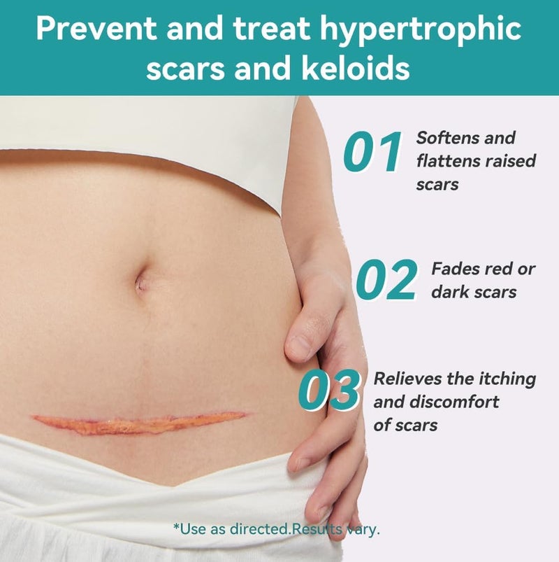 Dimora Hydrogel Burn Dressing 4 x 4  Waterproof Silicone Scar Sheets - Image 4