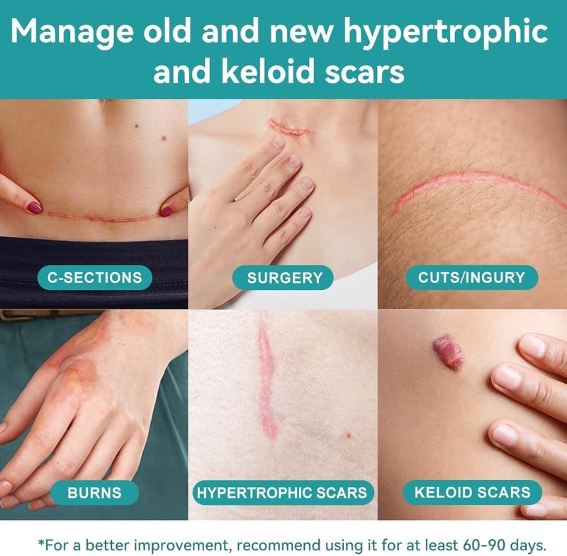 Dimora Hydrogel Burn Dressing 4 x 4  Waterproof Silicone Scar Sheets - Image 2