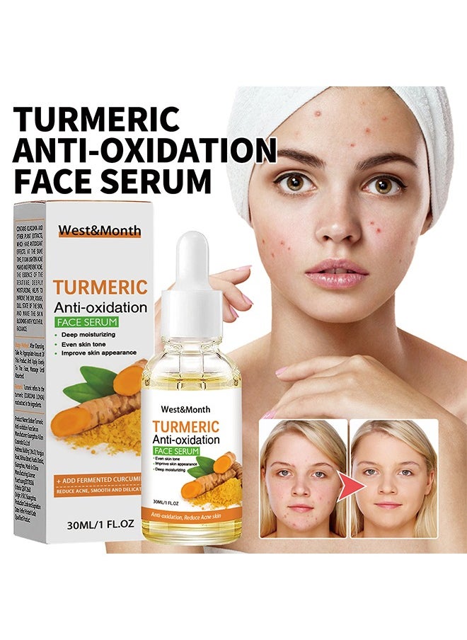 West&Month - Turmeric Anti-oxidation Face Serum - Dark Spot Corrector Serum, Turmeric Repair Face Serum, Bright Skin Dark Spot Corrector Face Whitening Serum, Hydrate Dull And Dry Skin 30ml - Image 1