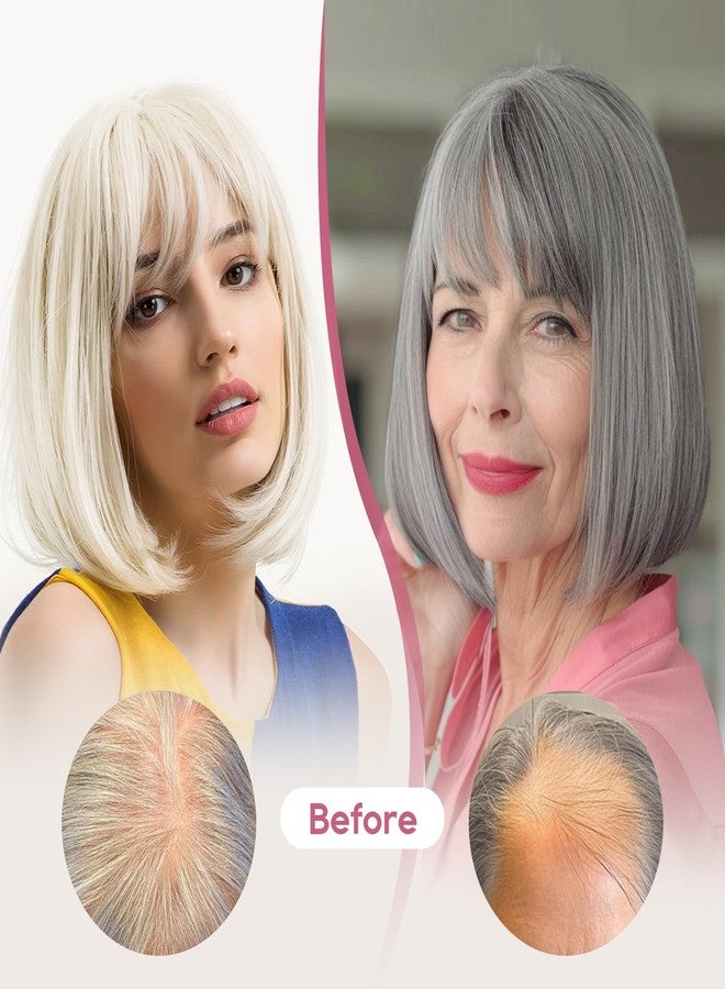 REECHO Human Hair Topper with Bangs for Women Real Human Hair Natural Hairpiece for Daily Wear, Medium Brown with Highlights - Image 5