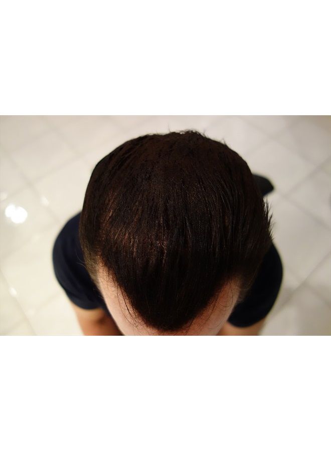 Finally Hair Hair Building Fibers Black 25 Grams Refill Your Existing Bottle. Highest Grade Fiber By Finally Hair (Black) - Image 4