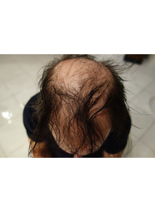 Finally Hair Hair Building Fibers Black 25 Grams Refill Your Existing Bottle. Highest Grade Fiber By Finally Hair (Black) - Image 3