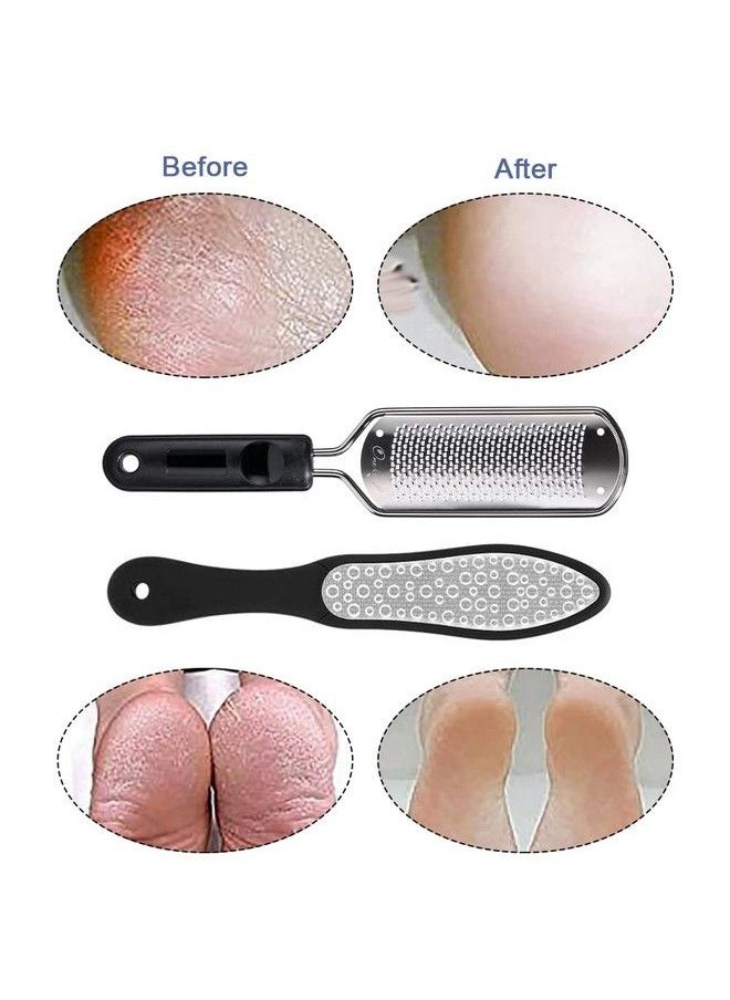 Oneleaf - 2Pcs Professional Pedicure Rasp Foot File Cracked Skin Corns Callus Remover For Extra Smooth And Beauty Foot (Black) (Black) - Image 1