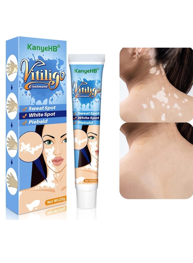 KanyeHB Vitiligo Ointment, Skin Vitiligo Treatment, Vitiligo Care Cream Reduces White Spots and Improves Skin Pigmentation (20g) - Image 1