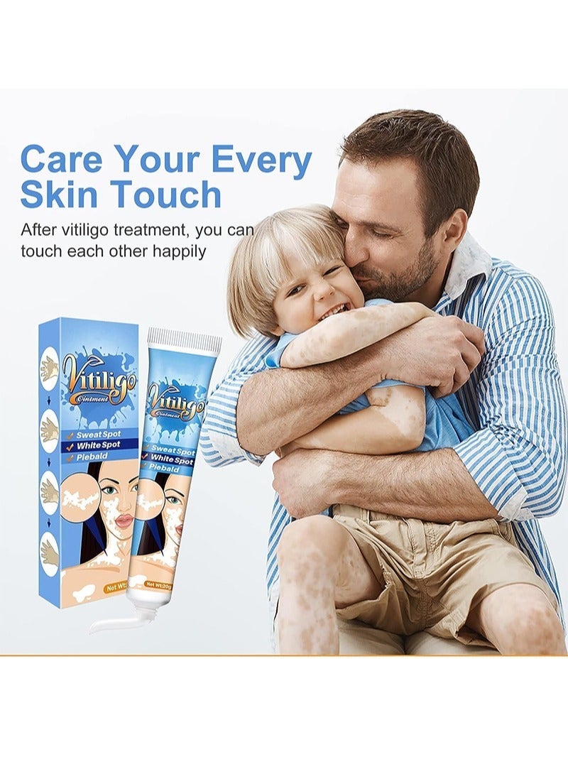 KanyeHB Vitiligo Ointment, Skin Vitiligo Treatment, Vitiligo Care Cream Reduces White Spots and Improves Skin Pigmentation (20g) - Image 5