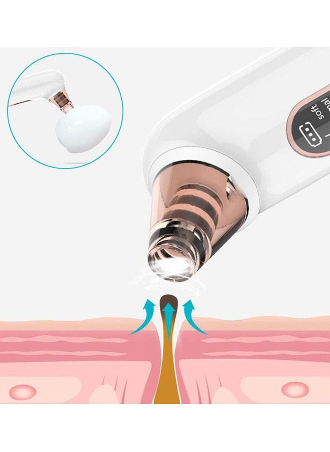 NIBEMINENT Electric Blackhead Remover Kit White  - Image 5
