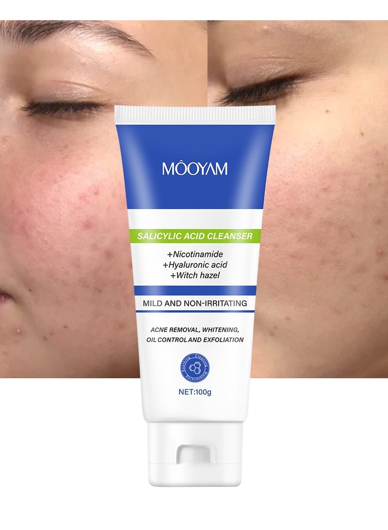 MOOYAM Salicylic Acid Cleanser for Acne, Deeply Cleanses & Exfoliates Acne Removal, Whitening, Oil Control and Exfoliation for All Skin 100g - Image 1