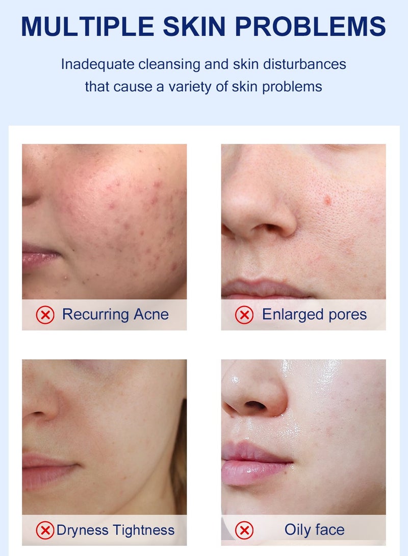 MOOYAM Salicylic Acid Cleanser for Acne, Deeply Cleanses & Exfoliates Acne Removal, Whitening, Oil Control and Exfoliation for All Skin 100g - Image 4