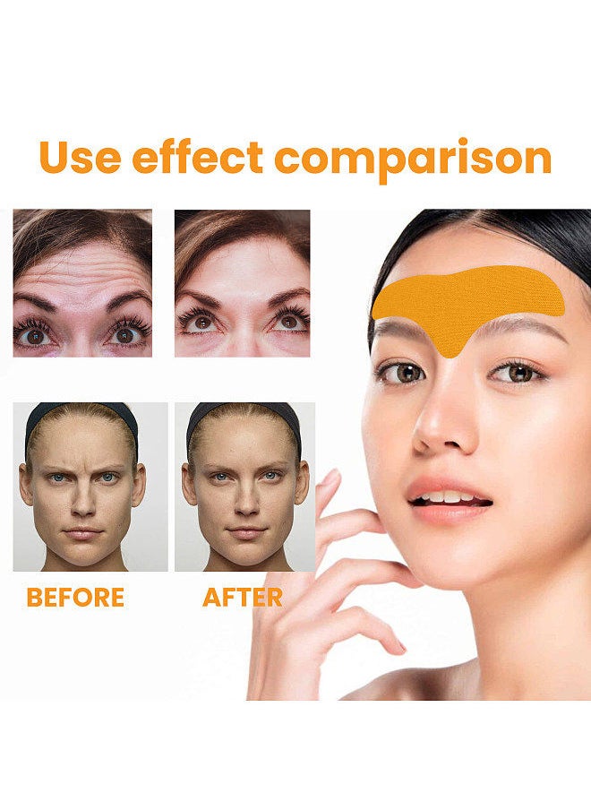 EELHOE 10pcs/Box Forehead Wrinkle Patch Smoothing Forehead Wrinkles Lifting and Firming Facial Skin Forehead Patch