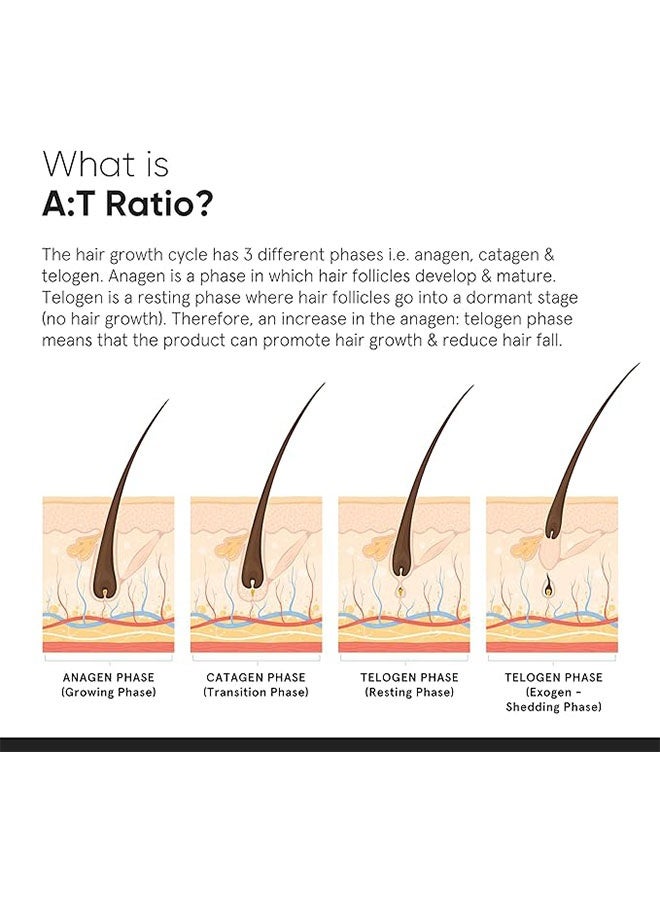 منيماليست مصل نشطات نمو الشعر 30 مل، يقلل من تساقط الشعر، يعزز النمو، مكافحة تساقط الشعر ونمو الشعر للرجال والنساء، مصل الشعر لجميع أنواع الشعر - Image 3