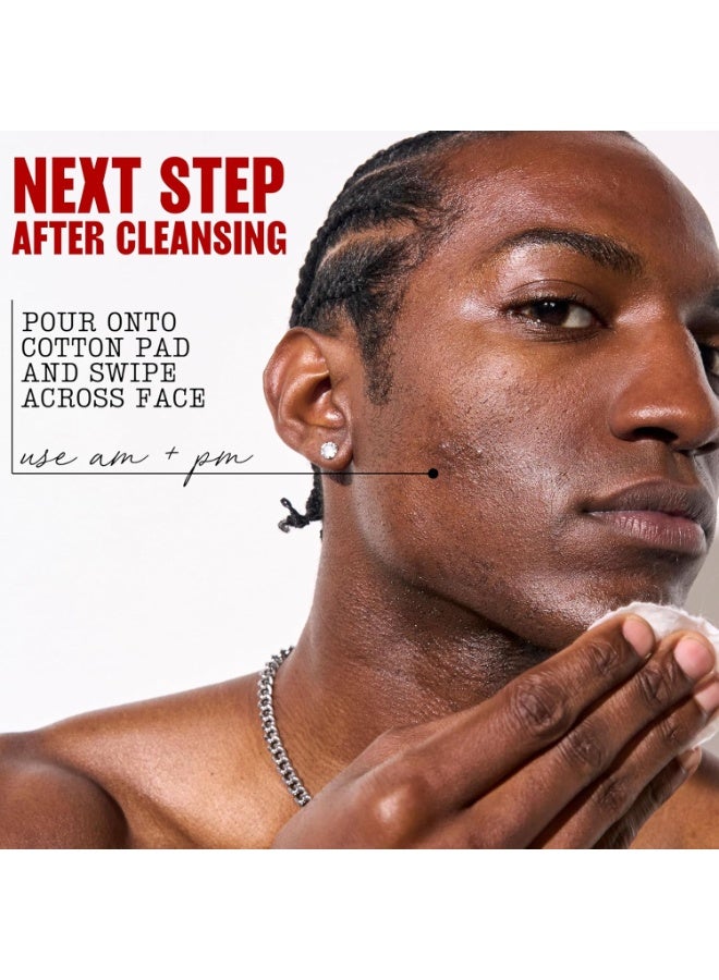 Thayers Blemish Clearing Acne Pads with 2% Salicylic Acid & Witch Hazel – Alcohol-Free, Gentle, Soothes Skin, Clears Blemishes, Blackheads & Whiteheads, 60 Count - Image 4