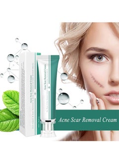 Breylee Acne Scar Removal Cream 30g Face Cream Skin Repair Skin Care Scar Acne Treatment Remove Stretch Marks Whitening Cream  - Image 2