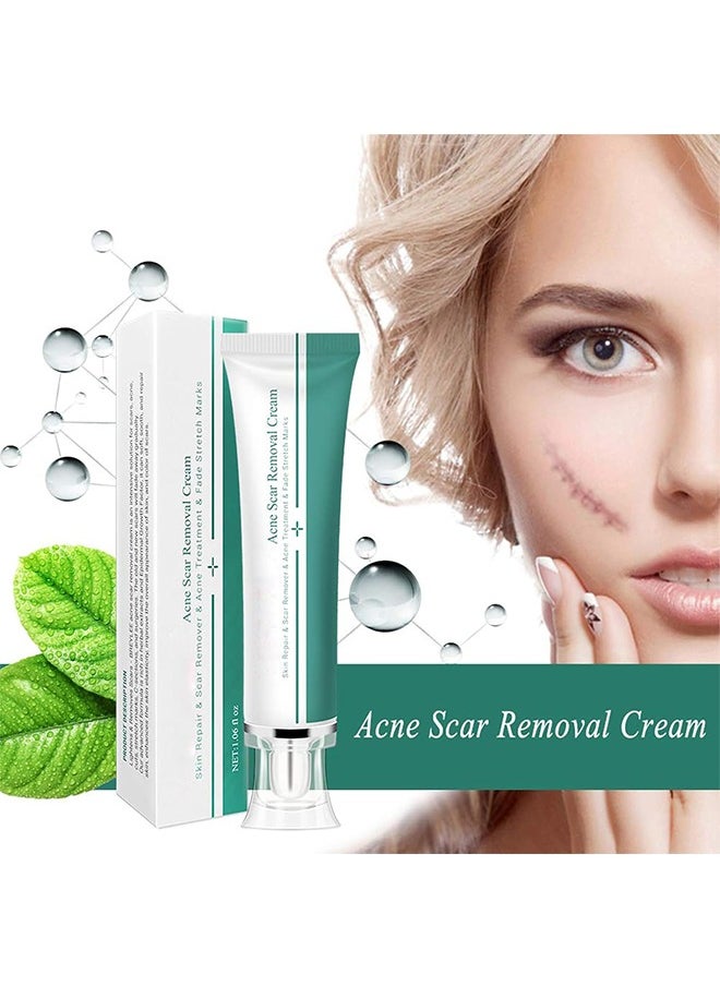 Breylee Acne Scar Removal Cream 30g Face Cream Skin Repair Skin Care Scar Acne Treatment Remove Stretch Marks Whitening Cream  - Image 2