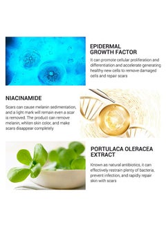Breylee Acne Scar Removal Cream 30g Face Cream Skin Repair Skin Care Scar Acne Treatment Remove Stretch Marks Whitening Cream  - Image 4