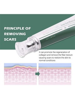 Breylee Acne Scar Removal Cream 30g Face Cream Skin Repair Skin Care Scar Acne Treatment Remove Stretch Marks Whitening Cream  - Image 5