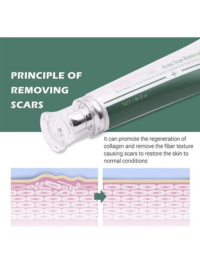 Breylee Acne Scar Removal Cream 30g Face Cream Skin Repair Skin Care Scar Acne Treatment Remove Stretch Marks Whitening Cream  - Image 5