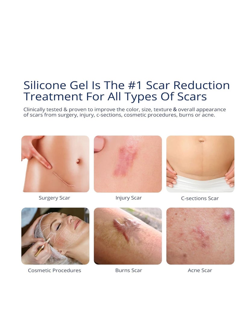 MURASAKI BEAUTY 100% Silicone Scar Gel Scar Cream - Advanced Scar Gel for Surgical Scars, C-Section, Stretch Marks, Acne, Injury, Burns, Keloids, Old and New Scars 1.06oz(30g) (Maximum Strength 100% Silicone) - Image 3