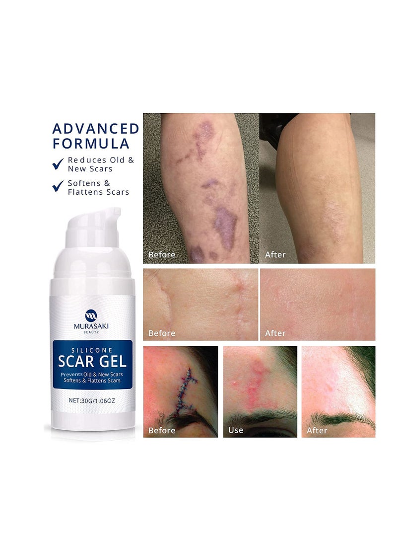 MURASAKI BEAUTY 100% Silicone Scar Gel Scar Cream - Advanced Scar Gel for Surgical Scars, C-Section, Stretch Marks, Acne, Injury, Burns, Keloids, Old and New Scars 1.06oz(30g) (Maximum Strength 100% Silicone) - Image 4