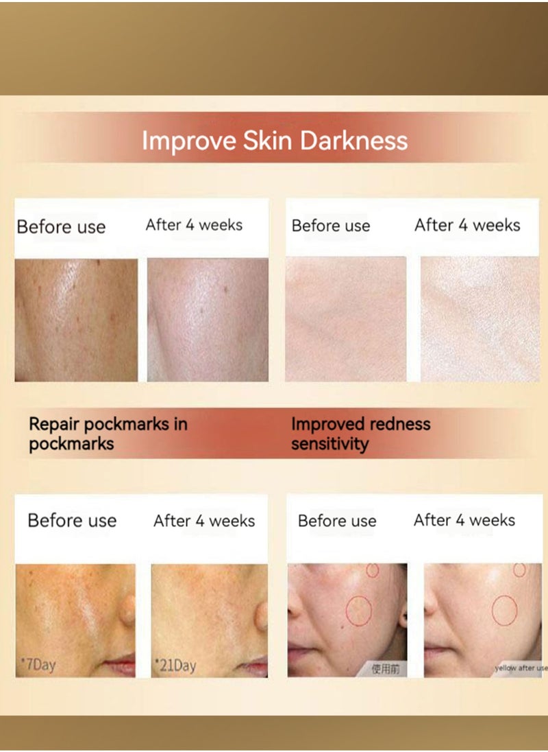 Parfaite Essence - Revolutionary Niacinamide Brightening Ampoule to help smooth skin, eliminate dullness, reduce pigmentation, matte face serum