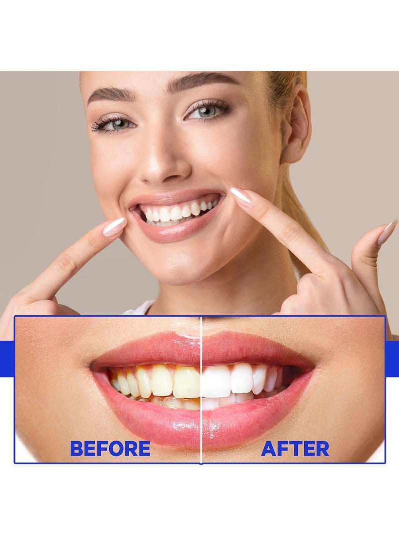 Blue Berry Remove Stains Whitening Toothpaste Fight Bleeding Gums Toothpaste Prevent Tooth Decay Promote Teeth Strong Gums Baking Soda - Image 4