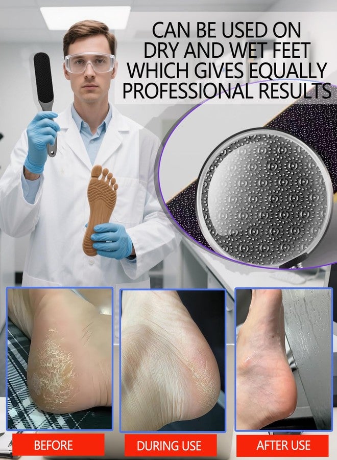 Maeysiph Double Sided Nano Glass Foot File - Hard Skin & Callus Remover, Beyond The Cream Foot File, Smooth Pedicure File for Feet, Wet & Dry Safe Hygienic Glass Foot Files for Feet - Image 3