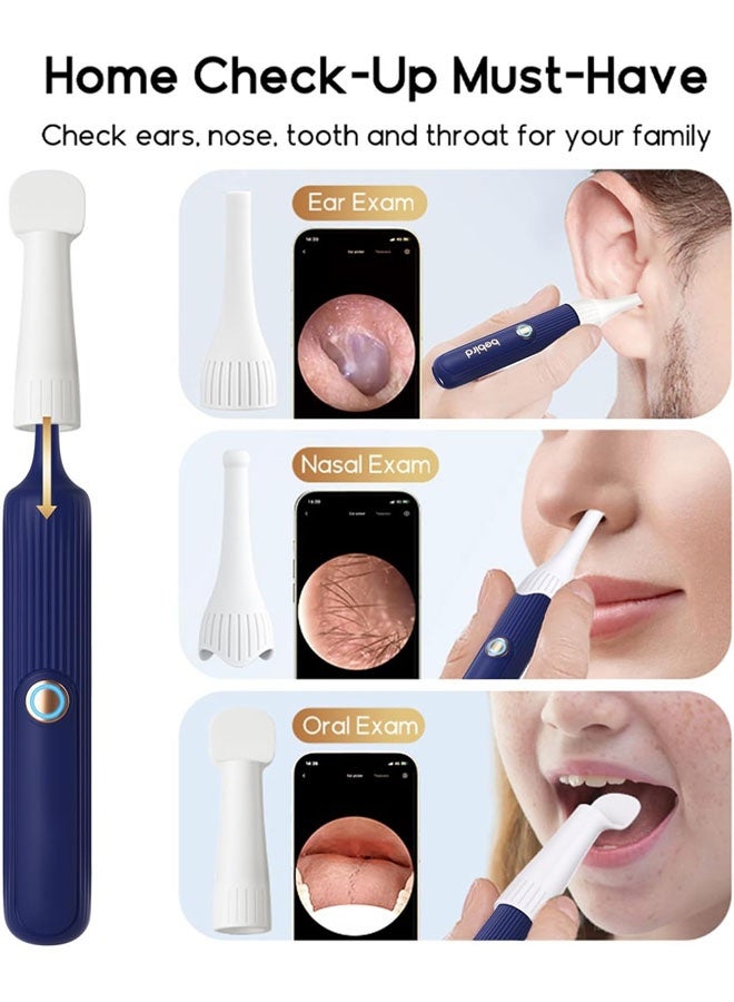 كيلا إزالة شمع الأذن، ملعقة إزالة الشمع المرئي عبر شبكة Wi-Fi، منظار أذن لاسلكي بدقة 1296 بكسل عالية الدقة مع ضوء LED لأجهزة iPhone وiPad وهواتف Android (أسود) - Image 5