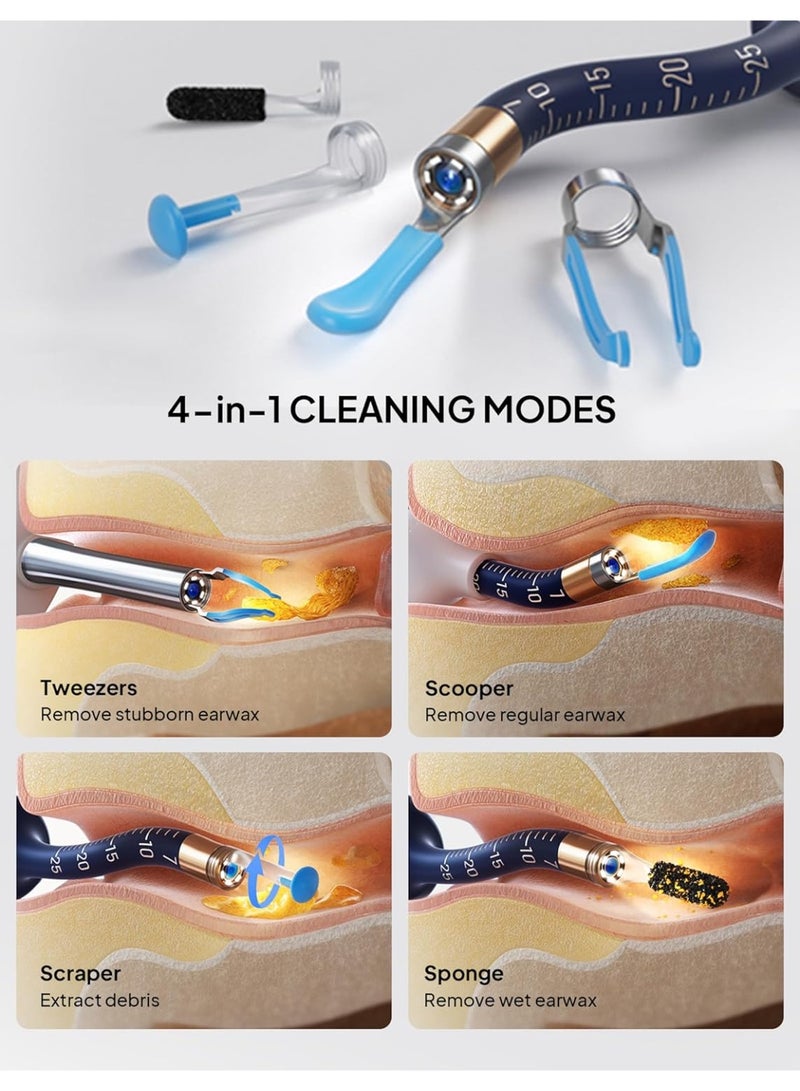 كيلا إزالة شمع الأذن، ملعقة إزالة الشمع المرئي عبر شبكة Wi-Fi، منظار أذن لاسلكي بدقة 1296 بكسل عالية الدقة مع ضوء LED لأجهزة iPhone وiPad وهواتف Android (أسود) - Image 3