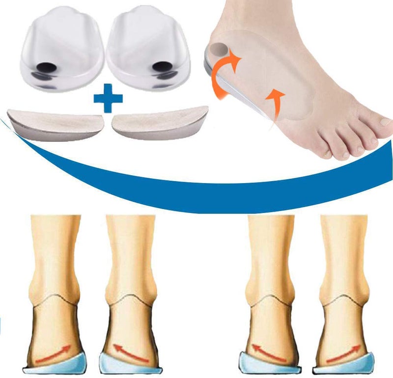 Mcvcoyh Orthopedic Insoles for Correcting OX Type Leg Shoe Inserts Built in Magnetic Heel Shoe Cushions for Foot Alignment Knock Knee Pain Bow Legs 2 Pairs