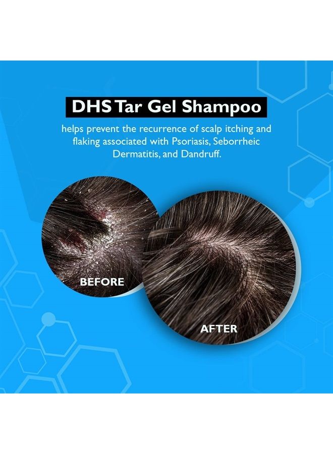 DHS Person & Covey, Inc T Gel Shampoo - Anti Dandruff Shampoo, Mildly Scented Psoriasis Shampoo - Refined Coal Tar Shampoo Gel Formula, Scalp Psoriasis Shampoo, Deep Cleansing Rich Lather - 8 Fl. Oz. - Image 5