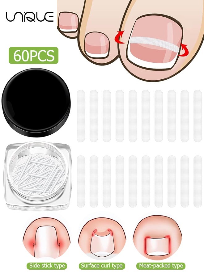 يونيك 60 قطعة مجموعة مصحح أظافر منغرسة - شرائط تصحيح أظافر منغرسة، مشبك لتقويم الأظافر، لصقة لإعادة تقويم أظافر منحنية للنساء والرجال للعناية بالقدم - شفاف - Image 1
