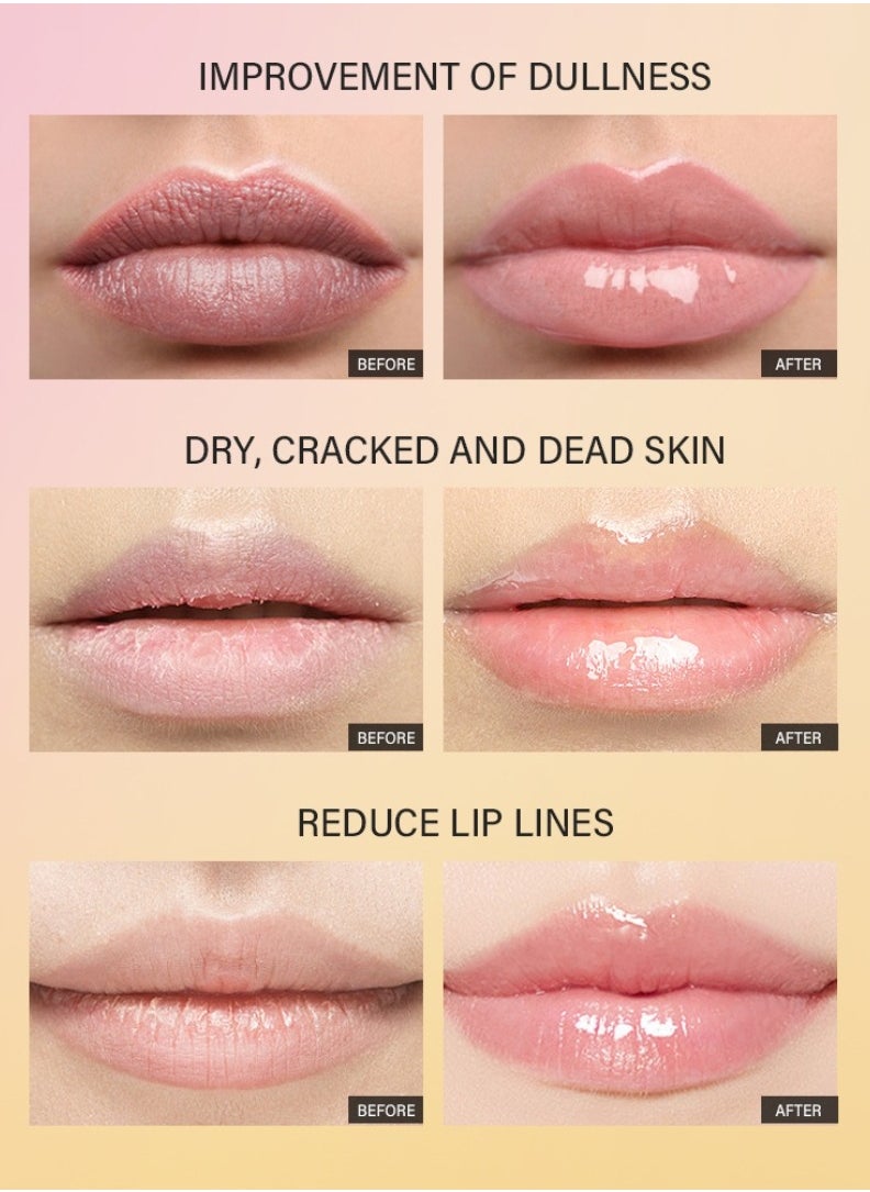 lakerain - Peptide Lip Treatment Gel No.02 Watermelon Moisturizes and Treats Lips Lip Gloss Oil for Plumper and Moisturizer Serum Hydrating Lip Serum for Dry Peeling and Dark Lips Gorgeous Glow 10ml - Image 1