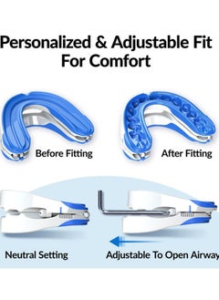 Joshberg Anti Snoring Devices Stop Snoring Adjustable Snoring Mouth Guard, Improve Sleep Quality  - Image 3