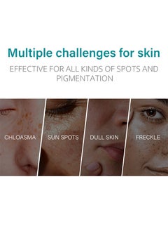 iBealee Dark Spot Remove Whitening Freckle Cream, for Face Peeling Skin Whitening Freckle Cream Pigmentation Treatment Sun Spots Age Spots Blemish Remover Lightening Cream  - Image 2