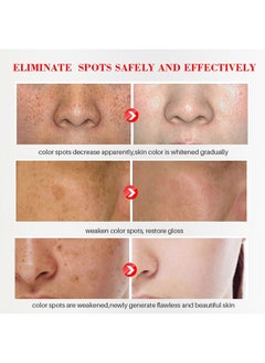 iBealee Dark Spot Remove Whitening Freckle Cream, for Face Peeling Skin Whitening Freckle Cream Pigmentation Treatment Sun Spots Age Spots Blemish Remover Lightening Cream  - Image 4