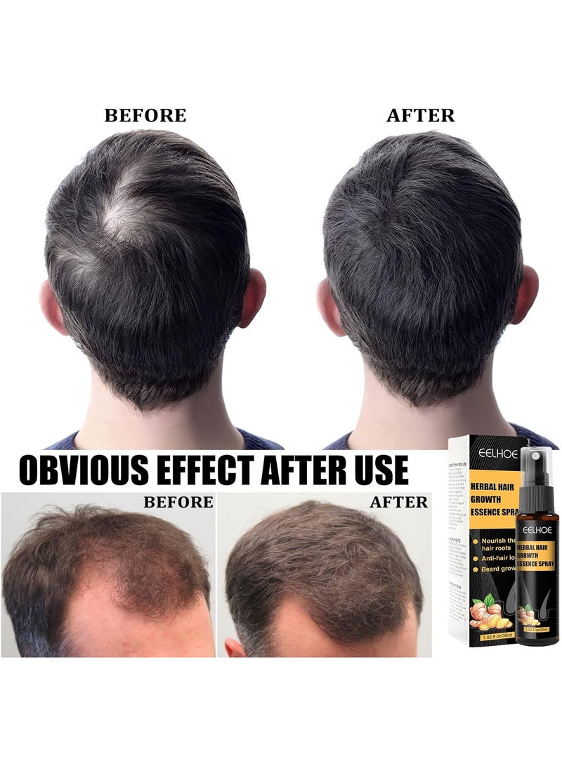 Eelhoe Hair Growth Essence Hair Loss Treatment Tonic Hair Loss Treatment Hair Treatment For Hair Dense Hair Regrowth Serum Prevent Hair Dry Frizzy Hair Beard Fast Growth Roller Thick Hair Kit Head Massage Roller Essence Easy To Carry For Men & Women(30ml) - Image 3