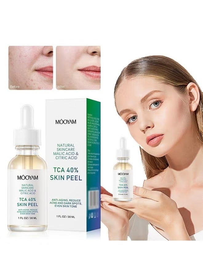 MOOYAM 40% Citric Acid Peeling Serum Chemical Peel for Face Peeling Solution Skin Peel Chemical Exfoliant for Face Exfoliating Facial Peel for Dark Skin Dark Spots Acne Spot 30ml - Image 1