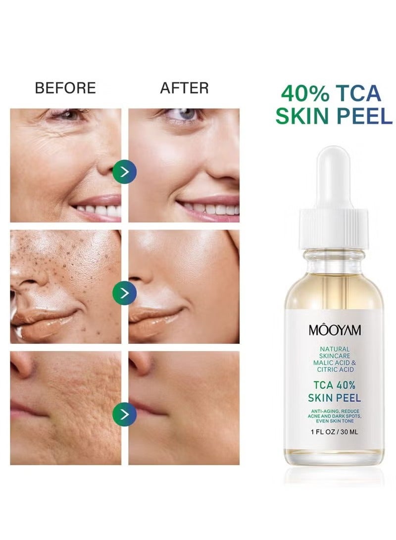 MOOYAM 40% Citric Acid Peeling Serum Chemical Peel for Face Peeling Solution Skin Peel Chemical Exfoliant for Face Exfoliating Facial Peel for Dark Skin Dark Spots Acne Spot 30ml - Image 1