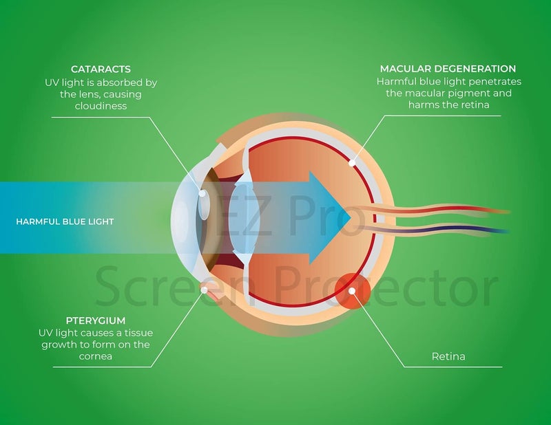 EZ-Pro Screen Protector Premium Anti Blue Light and Anti Glare Screen Protector (3 Pack) for 20 Inches Widescreen Desktop Monitor. Filter Out Blue Light and Relieve Computer Eye Strain to Help You Sleep Better - Image 2